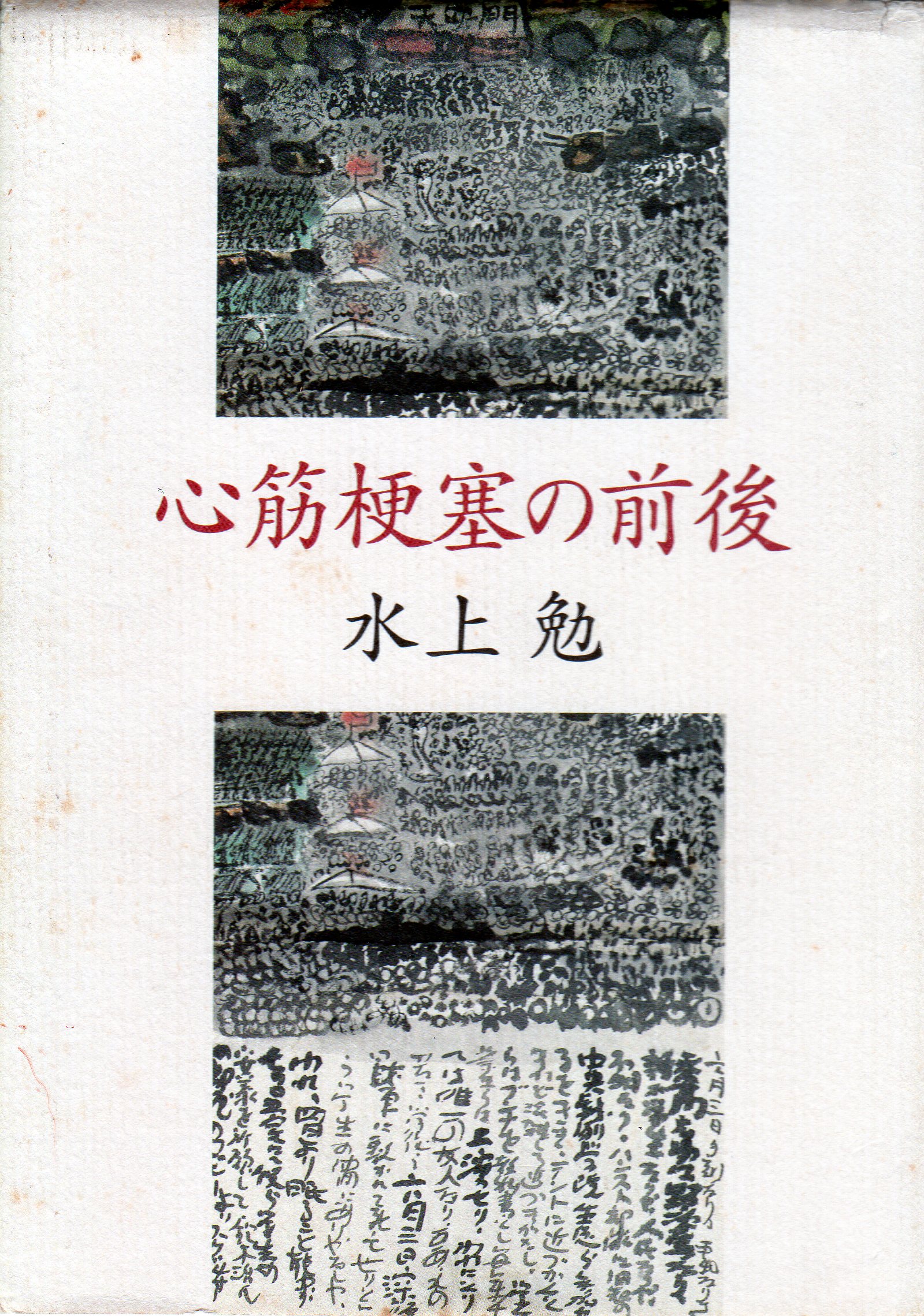 心筋梗塞の前後（しんきんこうそくのぜんご）のひょうし
